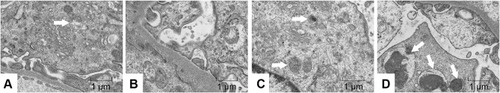 Figure 8 Effects of Emo on the autophagy of podocytes in rats with DN.