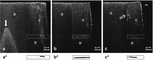 Figure 2. Representative cross-sectional CP-OCT images of group A after immersion in silver nitrate and developing solution