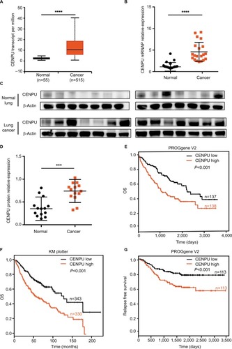 Figure 1 CENPU is overexpressed in NSCLC and predicts poor prognosis.Notes: (A) The mRNA expression data for CENPU in 515 human lung cancer tissues and 55 adjacent normal tissues were obtained from the UALCAN website. CENPU expression in lung cancer tissues was higher than that in adjacent normal tissues. (B) Quantitative reverse transcription PCR was performed to analyze the expression of CENPU in human NSCLC cancer tissues and paired adjacent normal tissues (n=20). (C) Western blotting was performed to analyze the expression level of CENPU in 14 paired human NSCLC cancer tissues and adjacent normal tissues. (D) The relative protein expression level was normalized to that of β-actin. (E, F) KM survival curve available on PROGene V2 and KM plotter website demonstrating decreased OS in the CENPU high expression group. (G) KM survival curve available on PROGene V2 website demonstrating decreased RFS in the CENPU high expression group. ****P<0.0001; ***P<0.001.Abbreviations: CENPU, centromere protein U; KM, Kaplan–Meier; NSCLC, non-small-cell lung cancer; OS, overall survival; RFS, relapse-free survival.