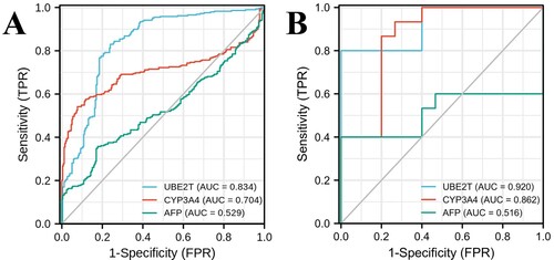 Figure 6. ROC curves of UBE2T, CYP3A4 and AFP for predicting the development trend of hepatocellular carcinoma in patients with cirrhosis. (A) Through the datasets collected from GSE98383, GSE63898, GSE17548, GSE89377 and GSE102451, 259 samples with liver cirrhosis and 288 samples with liver cancer were involved. The areas under ROC curve of UBE2T, CYP3A4 and AFP were 0.834, 0.704, and 0.529, respectively. (B) For the validation cohort of 15 paired HCC tissues and cirrhosis tissues, the areas under ROC curve of UBE2T, CYP3A4 and AFP were 0.920, 0.862, and 0.516, respectively.