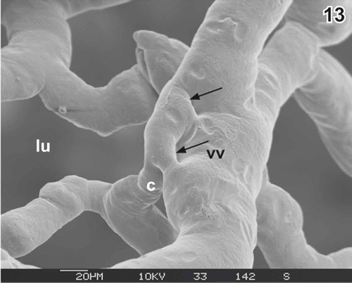 Figure 13. Same as Figure 12, but intussusception (arrows) in a more advanced state. c capillary, lu lumen of gallbladder, vv venule.