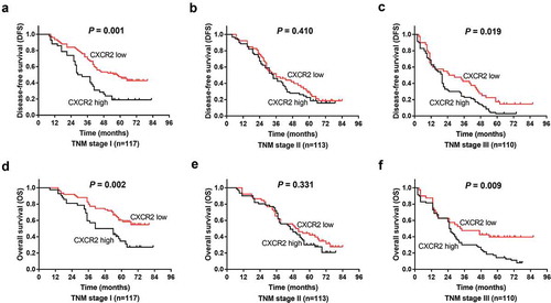 Figure 3. Comparison of survival between CXCR2 high expression and low expression patients in subgroups. DFS between CXCR2 high expression and low expression patients in patients with TNM stage I (A), II (B) and III (C). OS between CXCR2 high expression and low expression patients in patients with TNM stage I (D), II (E) and III (F). Kaplan–Meier curves were plotted to show the profiles of DFS and OS between the two groups, and the log-rank test was applied to determine the difference of DFS and OS between the two groups. P < 0.05 was considered significant. CXCR2, C-X-C Chemokine Receptor Type 2; DFS, disease-free survival; OS, overall survival.