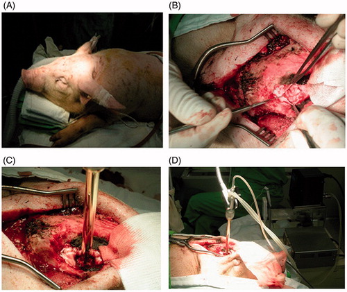 Figure 3. Photographs of the hyperthermia device being applied to a pig in pre-clinical experiment. (A) A total of six pigs were used in the pre-clinical animal experiment. (B) Right frontal craniectomy and partial resection of the frontal lobe were performed on a pig. (C) The hyperthermia device was applied to the surgically made brain cavity. The temperature of the surrounding brain tissues at 5 mm in depth from the cavity margin was elevated to 42.5 °C for a total of 60 min. (D) Photograph illustrating how the hyperthermia device was set up and applied to a pig.