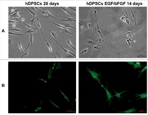 Figure 1. Differentiation of hDPSCs. (A) Morphology of hDPSCs from dental pulp untreated and treated with EGF/bFGF for 14 days. Scale bars, 50 μm. (B) Immunofluorescence analysis of neuronal marker β3-tubulin mAb expression. Scale bars, 50 μm.