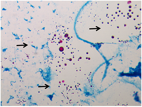 Figure 2 Microscopic morphology (400 x) of L-form NTM. (red spheroids, arrows).