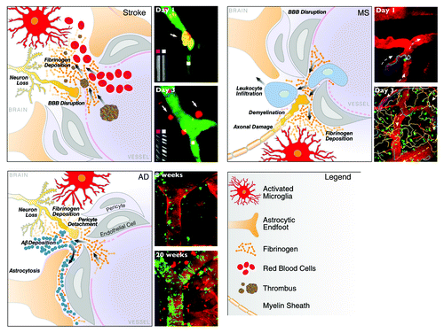 Figure 1. In vivo imaging of the neurovascular unit in stroke, MS and AD. Schematic representation of the dynamic alterations at the neurovascular unit in different neurologic diseases. Despite different origins, neuropathology and clinical disease progression, there are striking similarities in the cellular processes underlying breakdown of the neurovascular unit. Leakage of the BBB with entry of blood proteins, activation of microglia, astrocyte endfeet retraction, pericyte detachment, neuronal and axonal changes are key elements of cerebrovascular dysfunction. Repetitive in vivo imaging shows extravasation of micro-emboli causing alterations in CBF and restructuring of the microvasculature in stroke,Citation28 migratory paths of T cells after their attachment to the leptomeningeal vessels in a mouse model of MS,Citation45 and gradual progression of cerebral amyloid angiopathy over weeks as captured by time-lapse in vivo imaging in a transgenic mouse model of AD.Citation54 Images reproduced with permission.