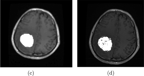 Figure 9. Segmentation results of the brain image. (c) the segmented image by the riesz distribution, (d) the segmented image by the Wishart distribution.