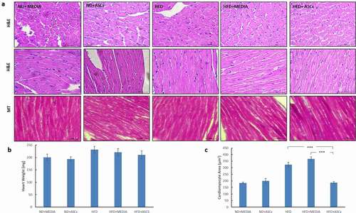 Figure 6. Adipose-derived mesenchymal stem cells attenuate cardiomyocyte hypertrophy induced by HFD in mice. (a) Representative images of transverse (upper panel) and longitudinal (middle and lower panels) cardiac muscle tissue sections from different animal groups stained with Hematoxylin/eosin (H&E) and Masson’s Trichrome (MT) stains. (b) Heart weight and (c) cardiomyocyte area were also quantified. Data are presented as mean ± SEM. *** represents statistical significance between groups at P < .001