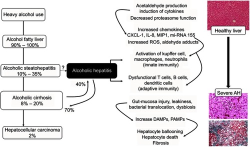 Figure 2 Etiopathogenesis of alcoholic hepatitis.