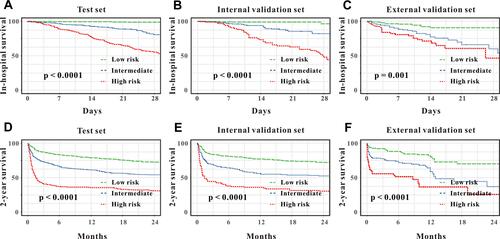 Figure 1 Kaplan–Meier curves for in-hospital survival for all patients stratified by ASII in the test set (A), in the internal validation ser (B), and in the external validation set (C). Kaplan–Meier curves for 2-year survival for all patients stratified by ASII in the test set (D), in the internal validation ser (E), and in the external validation set (F).