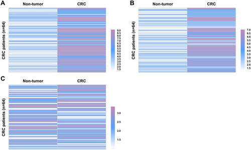 Figure 1 CRC tissues exhibited altered expression of circFAT1 and mature miR-10a. Tissue samples from a total of 64 CRC patients were subjected to total RNA extractions and RT-qPCRs to analyze the expression of circFAT1 (A), mature miR-10a (B) and premature miR-10a (C) in CRC. Heatmaps plotted using Heml 1.0 were used to express differential gene expression in paired tissues.