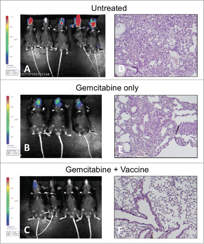 Figure 5. Combination therapy provides durable protection against tumor relapse and prevents metastasis to lung. IVIS imaging demonstrates significant cranial tumor burden in treatment-naive and gemcitabine-treated mice whereas only one of four mice that had received combination therapy exhibited any tumor burden. Histopathological analysis (H&E) revealed lung metastasis as well as sporadic metastases to other organs including liver in all treatment-naive and gemcitabine-treated mice. In contrast, no metastases were observed among any mice that had received combination therapy. (A/D) Treatment naive. (B/E) Treatment with gemcitabine only. (C/F) Treatment with combination therapy. Lung histopathology shown at 200×.