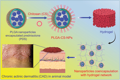 Figure 1. Graphical illustration of the chitosan (CS)-coated PLGA nanoparticles encapsulated prednisolone (PDS) and co-encapsulated to poloxamer hydrogel to enhance the treatment of chronic actinic dermatitis (CAD).