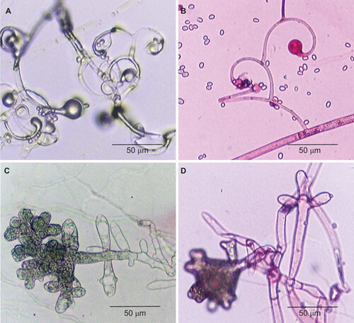 Figure 1 Microscopic examination of strain 1 (A and C, lactophenol cotton blue stain) and L. ramosa CBS124198 (B and D, acid fuchsin stain) showing branched sporangiophores with characteristic circinate side branches (A and B) and pleomorphic giant cells with finger-like projections (C and D). CBS, Centraalbureau voor Schimmelcultures.