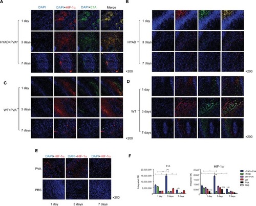 Figure 6 Immunofluorescent staining of HIF-1α and E1A at days 1, 3, and 7 post the first interventional manipulation.Notes: (A–D) Double immunofluorescent labeling of HIF-1α and E1A in HYAD perfusion combined with PVA embolization, simple HYAD perfusion, WT perfusion combined with PVA embolization, and simple WT perfusion groups, respectively. (E) Immunofluorescent staining of HIF-1α in PVA embolization and PBS perfusion (control). (F) Semiquantitative analysis of the staining by integrated optical density demonstrating the expression levels in different groups. Each data point indicates mean ± SD. *P<0.05; **P<0.01; ***P<0.001.Abbreviations: HYAD, hypoxia-replicative oncolytic adenovirus; HYAD+PVA, HYAD combined with PVA particle embolization; PVA, polyvinyl alcohol; WT, wild adenovirus type 5 perfusion; WT+PVA, WT combined with PVA particle embolization.