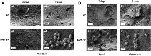 Figure 6 Scanning electron microscopy of HEK-293T (A), Saos-2 and osteoclast cells (B) grown on buckypapers at different time points (3 and 7 days). Scale bars are 10 µm.