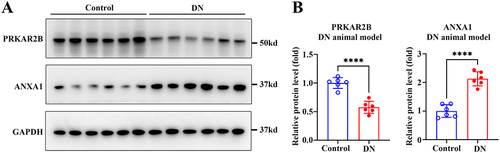 Figure 9 Detection of the protein levels of PRKAR2B and ANXA1 in the experimental DN animal model. (A) The protein levels of PRKAR2B and ANXA1 in the kidney tissues of mice with STZ/HFD-induced DN and in those of the control mice. (B) Quantitative grey values of protein expression are shown. Data are shown as mean ± SD from groups of six mice. ****p-value < 0.0001.