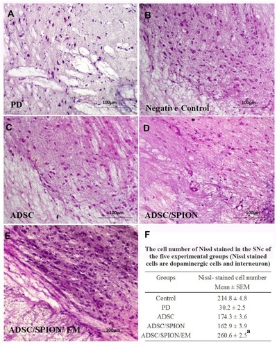 Figure 7 Images of hematoxylin and eosin (H & E) staining of brain sections in SNc and VTA regions in the untreated (PD) groups (A), negative control (B), and ADSC (C), ADSC/SPION (D) and ADSC/SPION/EM (E) test groups. The scale is 100 μm in all images. In addition, Figure (F) shows the number of neural cells counted in SNc and VTA regions with cresyl violet staining. a: Statistically different from PD, ADSC, and ADSC/SPION (P<0.02).