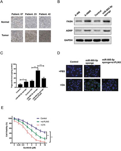 Figure 5. PLIN3 upregulation contributes sunitinib resistance by promoting lipid droplets formation. (a) IHC staining of PLIN3 expression in ccRCC tumor tissues versus adjacent normal tissues (×200); (b)Western blot analysis of FASN fatty acid synthase. and ADRP Adipophilin. expression level; (c) Triglyceride concentration in miR-885-5p sponged and control A-498 cells at steady state or after oleic acid OA feeding; (d) LipidTox staining of miR-885-5p sponged and control A-498 cells at steady state or after OA feeding; (e) Cell viability assay of miR-885-5p sponged A-498 cells with PLIN3 knockdown (30 µM si-PLIN3) or FASN inhibition (10 µM C75). Data are showed as mean ± SD of three independent experiments. *P < 0.05, ***P < 0.001.