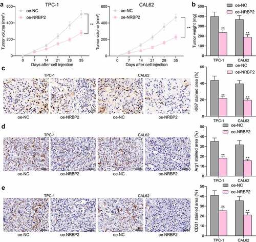 Figure 4. NRBP2 reduces TC tumorigenesis and M2 macrophage infiltration in vivo. (a), growth rate of xenograft tumors formed by TPC-1 and CAL62 cells in nude mice; (b) tumor weight on day 36; (c)-(e), expression of KI67, Arg1 and CD31 in xenograft tumor tissues examined by IHC. In each group, n = 6. **p < 0.01 vs. oe-NC.