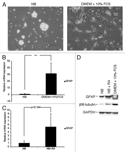 Figure 1. GBM neurosphere cells can be induced to differentiate in vitro. (A) GBM neurosphere cells grow with a differentiated morphology upon serum exposure. Scale bar shows 100 µm. (B) GFAP mRNA is upregulated in GBM neurosphere cells when grown in serum containing media. (C) RA induces upregulation of GFAP mRNA in GBM neurosphere cells. Q-RT-PCR reactions are presented as mean mRNA expression ± SD. Statistical significance was calculated using the Student two-sided t test. ***P < 0.005. (D) GFAP and β-III-tubulin protein are upregulated after exposure to serum or RA.