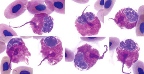 Figure 1. Heterophil projections in the blood film of an injured gopher tortoise at day of admission. The projections are in the same color as heterophil granules and visible as rows of individual or fused heterophil granules (up to 30 m in length) that were arranged in semi-circular or circular formations. ×100 objective. Wright-Giemsa stain.