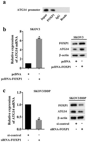 Figure 4. Effect of FOXP1 on ATG14 expression. (a) The interaction of FOXP1 and ATG14 promoter was measured using a ChIP assay. (b) The SKOV3 cells were transfected with pcDNA-FOXP1, and the mRNA and protein levels of ATG14 were detected using qRT-PCR and Western blot assay. (c) The SKOV3/DDP cells were transfected with siRNA-FOXP1, and the mRNA and protein levels of ATG14 were detected using qRT-PCR and Western blot assay. Three independent experiments with biological repeats. *P < 0.05, vs. pcDNA or si-control