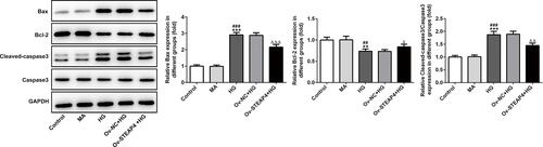 Figure 7 Overexpression of STEAP4 decreased apoptosis of HRCECs induced by HG. The expression of Bcl2, Bax, Cleaved caspase3, Caspase 3 was detected by Western blot. n=3, **p<0.01, ***p<0.001 vs Control; ##p<0.01, ###p<0.001 vs MA, Δp<0.05, ΔΔp<0.01, ΔΔΔp<0.001 vs Ov-NC+HG.Abbreviations: Ov-NC, overexpression-NC; Ov-STEAP4, overexpression-STEAP4; HG, high glucose.