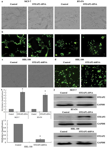 Figure 2. Determination of the efficiencies of STEAP2 up-regulation and down-regulation. (a) Phase contrast images and (b) GFP fluorescence images showed effective transfection efficiencies in breast cancer cell MCF-7 and BT-474 infected with STEAP2 or negative control cDNA. (c) Phase contrast images and (d) GFP fluorescence images showed effective transfection efficiencies in normal mammary epithelial cell line HBL-100 infected with STEAP2 or negative control shRNA. STEAP2 expressions of control or STEAP2 cDNA infected MCF-7 and BT-474 cells, and in control or STEAP2 shRNA infected HBL-100 cells were measured by (e) real time RT-qPCR and (f) western blotting (cropped blot). The results of the above studies demonstrated the success and effectiveness of over-expression and knockdown transfection. (Magnification ×200). *P < .05.