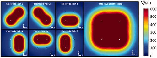 Figure 4. Visualization of the electric field distributions for each electrode pair. The combined maximum intensity of each individual field represents the effective electric field distribution from treatment with this four electrode array. This sequence of pulsing represents the conventional NanoKnife® pulsing scheme.
