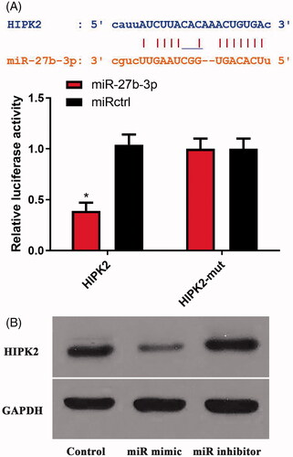 Figure 2. MicroRNA-27b-3p regulated HIPK2. (A) The regulation between miR-27b-3p and HIPK2 was evaluated using dual-luciferase reporter gene assays. (B) MiR-27b-3p regulated the protein expression of HIPK2.