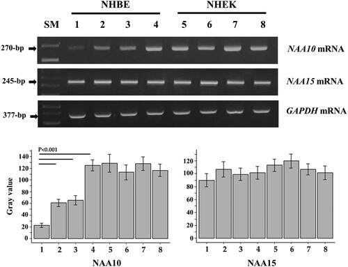 Figure 1. Expression of NAA10 mRNA in NHBE cells and NHEKs exposed to PM. Cells were treated with PM10-PAH (lanes 2 and 6), PM10 (lanes 3 and 7), and PM2.5 (lanes 4 and 8) at the final concentration of 50-μg/ml for 3 days. Cells exposed to vehicle (1% PBS and 0.1% DMSO) were used as the untreated control group (lanes 1 and 5, respectively). Expression of NAA10 and NAA15 mRNAs was analyzed by semi-quantitative RT-PCR and electrophoresis using 2% agarose gel, where bands appeared at positions corresponding to the expected lengths. GAPDH expression was used as an internal loading control. Band intensity values were semi-quantitatively analyzed with ImageJ 1.53t program and the relative amount of NAA10 and NAA15 mRNAs, normalized to housekeeping gene GAPDH levels, were expressed as gray values. SM, 100-bp ladder.