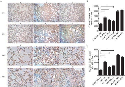 Figure 8 C. psittaci burden and pathological assessment in lung tissue measured by IHC.Notes: (A) The infected lungs were sectioned and stained with S-P immunohistochemistry using an UltraSensitive™SP (Rabbit) IHC Kit with rabbit anti-C. psittaci 6BC antibody used as the primary antibody. (a) SIM-CNPs-Ags group, (b) SIM-Ags group, (c) IN-CNPs-Ags group, (d) IM-CNPs-Ags group, (e) IN-CNPs-PBS group and (f) IM-CNPs-PBS group. Brown granules (black arrow) indicate C. psittaci inclusions in the nuclei of the lung tissue cells. (B) C. psittaci positive count per 100× field. (C) C. psittaci positive count per 400× field. Each bar indicates the mean ± SD from three independent experiments. *P < 0.05; **P < 0.01.Abbreviations: IHC, immunohistochemistry; S-P, streptavidin-peroxidase; SIM, simultaneous; IM, intramuscular; IN, intranasal; CNPs, chitosan nanoparticles; PBS, phosphate-buffered saline.