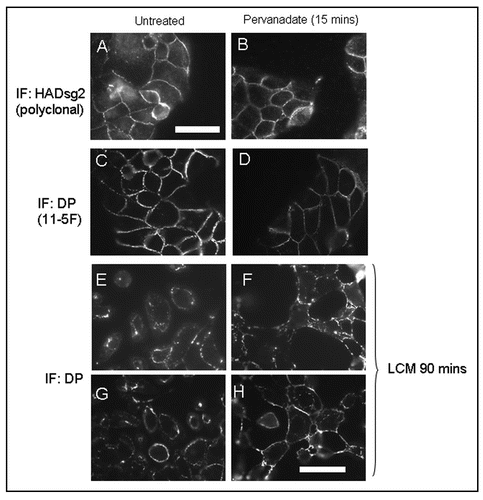 Figure 1 (A–D). Pervanadate treatment does not affect distribution of desmosomal proteins. MDCK cells expressing mDsg2HA (see Fig. 2) were plated at a density of 1.25 × 104 cells/cm2. After 48 hours the subconfluent cultures were either untreated (A and C) or treated for 15 minutes with pervanadate prior to fixation and processing for indirect immunofluorescence (B and D). Exogenous Dsg2 was stained using a polyclonal anti-HA antibody and DP monoclonal antibody 11–5F. Pervanadate treatment for this duration caused no apparent alteration in the junctional distribution of either ectopic HAmDsg2 or endogenous DP. (E–H) Stabilization of desmosomes by pervanadate. Subconfluent cultures were either untreated or pretreated with pervanadate for 15 minutes and then switched to low-calcium medium (LCM) for 90 minutes. Switching untreated cells to LCM caused them to lose the junctional distribution of DP as desmosomes were internalized and cells detached from one another (E and G). Pervanadate-treated cells switched to LCM showed intense DP staining at areas of mutual adhesion even though there was considerable retraction at other parts of the cell surface (F and H). Bars = 25 µm. That in (A) is for (A–D) and that in (H) for (E–H).