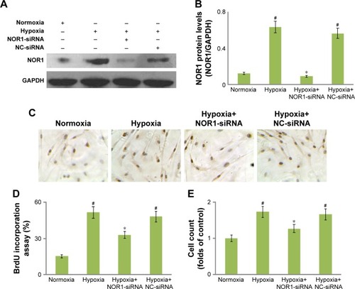 Figure 3 NOR1-specific siRNA inhibited proliferation in hypoxic cells.