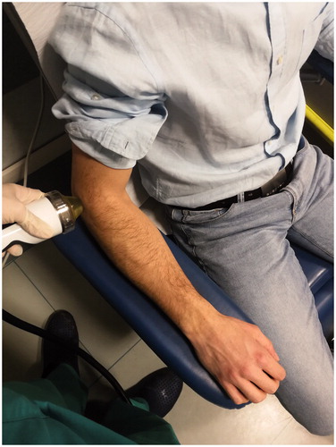 Figure 3. ESWT performed to the elbow.
