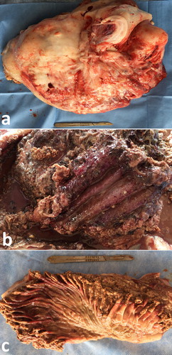 Figure 24. Abdominal enlarged hard mass weighting 10.5 kg (a). The cut section of the mass showing the abomasal (b) and omasal (c) folds were thickened, congested and ulcerated.