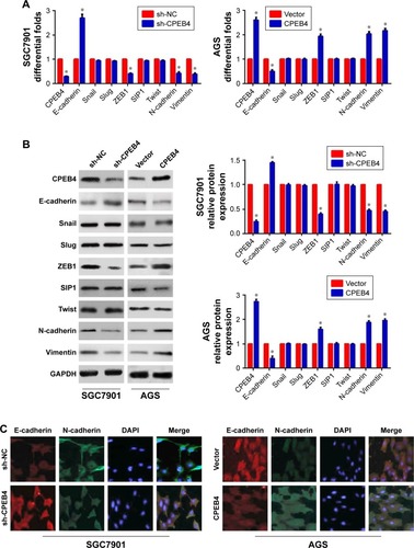 Figure 3 Effects of different expression levels of CPEB4 on EMT-related markers in SGC7901 and AGS cells.