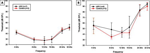 Figure 2. Breeder female ABR thresholds. Mean ABR thresholds from female breeder mice from Groups exposed to ARVs (ARV) and controls (CON). Error bars are ± 1 s.d. (A) Pre-exposure thresholds at the beginning of the experiment, prior to any breeding or dosing with ARV compounds. (B) Thresholds at the conclusion of the experiment. The ARV (black lines) and CON (red lines) groups were not significantly different from each other at any frequency or time point.