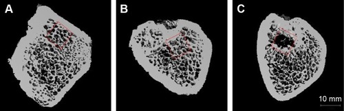 Figure 6 Osteogenic observation of various peptide hydrogels 8 weeks after implantation.