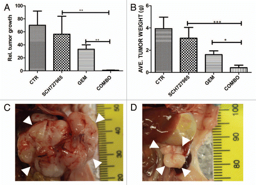 Figure 6 Combination treatment of orthotopic pancreatic cancer xenografts with SCH727965 and gemcitabine. The low passage pancreatic cancer xenograft Panc265 was implanted orthotopically into nude mice. Ten days later, tumor volume was measured by ultrasound, and mice (eight per group) were randomized into four treatment groups (vehicle-only control, SCH727965 only, gemcitabine only, and combination SCH727965 and gemcitabine), and treatment was initiated. SCH727965 (40 mg/kg) and gemcitabine (20 mg/kg) were each given twice weekly, as described in Materials and Methods. After 3 weeks of treatment, tumors were harvested and weighed. (A) relative tumor growth, calculated as (final tumor volume minus initial tumor volume/initial tumor volume); (B) average tumor weight (in grams) upon culmination of therapy. *p < 0.05; **p < 0.01; ***p < 0.001. (C) Representative macroscopic picture of mock treated intrapancreatic xenograft tumor (white arrowheads) at the end of treatment as compared with (D) combination treatment with SCH727965 plus gemcitabine. Note the different scales (indicated in mm at the right side of each image) in (C and D).