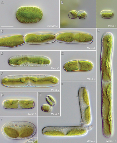Figure 3. Morphological diversity of Mesotaenium-like zygnematophytes (differential interference contrast). (a) Strain GSM.5.thin (Serritaenia testaceovaginata). (b) Strain KH.2.sm (lineage Meso-1). (c) Strain SAG 12.97 sometimes referred to as “M. endlicherianum” (lineage Meso-2). (d) Strain E.1 (lineage Meso-3). (e) Strain GSM.2.16.s2 (lineage Meso-8). (f) Strain SAG 230–1 (lineage Meso-9). (g) Strain GSM.2.16.l (lineage Meso-5). (h) Strain SAG 1.88 (lineage Meso-4). (i) Strain LM.24 (lineage Meso-6). (j) Strain CCAC 2215 (lineage Meso-7). (k) Strain UTEX 1025 (lineage Meso-10). Scale bar in (a) is 10 µm and applies to all panels.