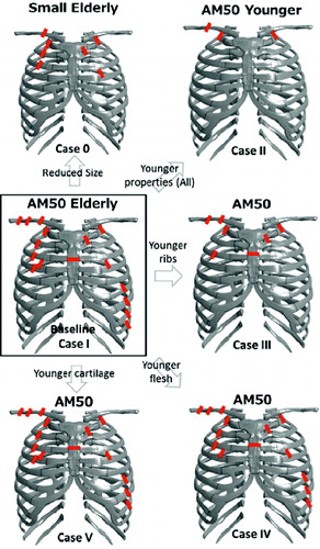 Figure 6 Bony fracture locations from the simulated cases in the parametric study.