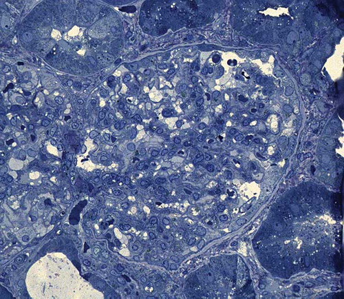 Figure 1. Light microscopic examination. Glomerulus (center of image) and an adjacent segment. Mesangiocapillary architecture is preserved (Toluidine blue ×400).