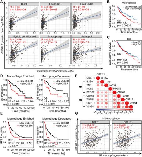 Figure 4 Relationship between QSER1 gene expression and immune infiltration. (A) Correlation between QSER1 and six kinds of immune cell infiltration in the TIMER database. (B) The effects of macrophages on the prognosis of HCC. (C) The effects of dendritic cells on the prognosis of HCC. (D) The impact of QSER1 gene expression and macrophage infiltration on OS. (E) The impact of QSER1 gene expression and macrophage infiltration on RFS. (F) Correlation analysis between QSER1 and M1/M2 macrophage markers. (G) The degree of correlation between QSER1 and M2 macrophage markers (TGFB1 and CSF1R).