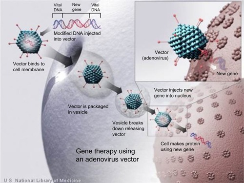 Figure 1 Gene therapy using an adenovirus vector.