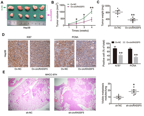 Figure 6 CircRASSF5 inhibits the growth and metastasis of HCC in vivo. (A) We applied BALB/c nude mice to construct the subcutaneous xenograft model by subcutaneously injected with circRASSF5 overexpression Hep3B cells and the control cells when mice were 6-week-old (5 mice in each group). Four weeks later, mice were sacrificed and the tumor size was measured. (B) We measured the tumor volumes once a week, and the growth curves of them in each group were analyzed and presented. (C) The relative weight of each tumor was calculated and analyzed between two groups. (D) Immunohistochemistry (IHC) assay was conducted to evaluate the ratio of Ki-67 and PCNA positive cells in the tumor tissues of subcutaneous xenografts (original magnification ×100). (E) A lung metastasis model was established by injecting MHCC-97H cells into mice through tail vein. And then the lung colonization was evaluated by the histological examination (H&E) (original magnification ×100). The results are shown as the mean ± SD. *P < 0.05; **P < 0.01.