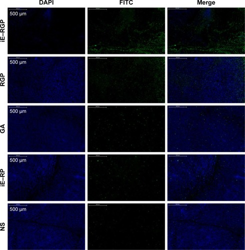 Figure 7 Apoptosis at tumor site following intravenous injection of iE–RBCm–GA/PLGA NPs (iE–RGP), RBCm–GA/PLGA NPs (RGP), free GA, iE–RBCm–PLGA NPs (iE–RP), and NS.Notes: Green apoptotic cells and blue active cancer cells are shown in the images of tumor sections. Scale bar =500 µm.Abbreviations: GA, gambogic acid; NPs, nanoparticles; NS, normal saline; PLGA, poly(lactic-co-glycolic acid); RBCm, red blood cell membrane.