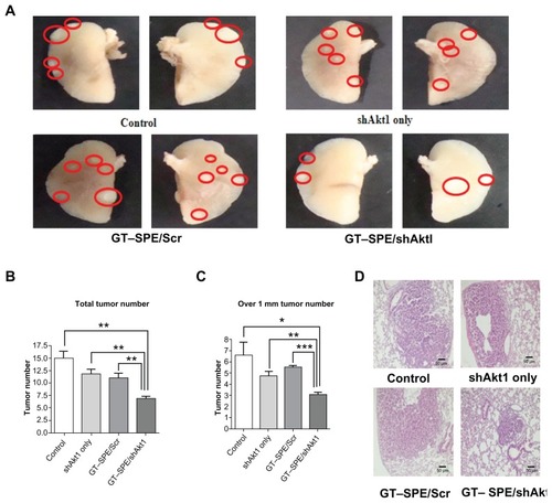 Figure 3 Therapeutic efficiency of GT–SPE as an aerosol gene delivery carrier in lung cancer model K-rasLA1 mice. Aerosol delivery of GT–SPE/Akt1 shRNA significantly inhibited lung tumor numbers and tumorigenesis. (A) Lung tumor lesions. (B) Total tumor numbers (n = 4, **P <0.01 compared to shAkt1 only, GT–SPE/Scr, and control). (C) Tumor size over 1 mm; tumor numbers (n = 4, *P <0.05 compared to control; **P < 0.01 compared to shAkt1 only; ***P < 0.001 compared to GT–SPE/Scr). (D) Histopathological features (Magnification, 200×).Abbreviations: GT–SPE, glycerol triacrylate–spermine; MMP-9, matrix metalloprotease-9; PCNA, proliferating cell nuclear antigen; shAkt1, small hairpin Akt1.