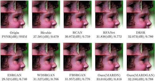Figure 9. “Head” image reconstruction in Set5 dataset by different SR algorithms: (a) origin PSNR(dB)/SSIM, (b) bicubic 27.581(dB)/0.679, (c) RCAN 30.872(dB)/0.759, (d) RFANet 31.836(dB)/0.772, (e) DRSR 32.073(dB)/0.780, (f) ESRGAN 29.521(dB)/0.740, (g) WDSRGAN 31.527(dB)/0.766, (h) FBSRGAN 31.957(dB)/0.776, (i) ours(MARDN) 33.010(dB)/0.818 and (j) ours(MARDGAN) 32.246(dB)/0.788.